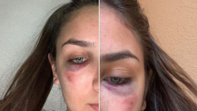 Photo of Reprezentativke BiH u karateu Ema i Ena Selman pretučene u svom stanu