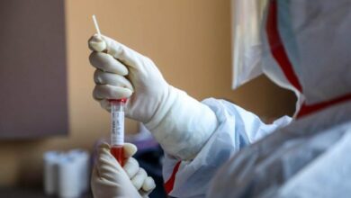Photo of Gdje se sve u FBiH može uraditi PCR test na koronavirus koji od danas košta 140 KM