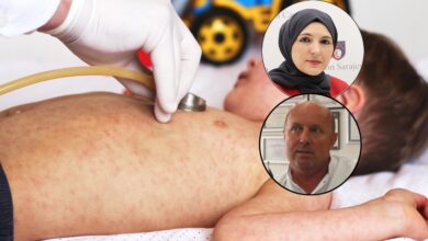 Photo of Epidemija morbila ne jenjava, odgovorni u KS ne znaju šta dalje: Zašto vlast ne zatvori vrtiće