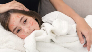 Photo of Epidemija morbila u ZDK: Devet pacijenata u srednje teškom stanju, vakcinacija jedino rješenje