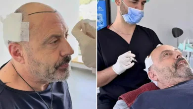 Photo of Sejo Sexon presadio kosu: Ovako bh. muzičar izgleda nakon zahvata