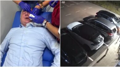 Photo of Branislav Borenović, državni zastupnik, nakon napada za “Avaz”: Uvjeren sam da je moguće doći do istine