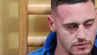 Photo of Trener rukometaša Goražda pokazao povrede koje je zadobio u napadu tokom utakmice u Sarajevu