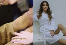 Photo of Severina pokazala modrice nakon što je pala na koncertu: Kaže meni jedna: “Nisi za trčanje, stara si”