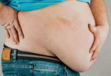 Photo of Više od dvije milijarde ljudi bit će gojazno do 2030.