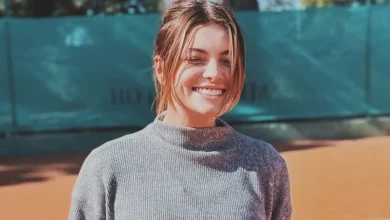 Photo of Ella Dvornik podvrgnula se estetskim zahvatima lica i pokazala prve rezultate: Nikad nisam skrivala ovakve stvari